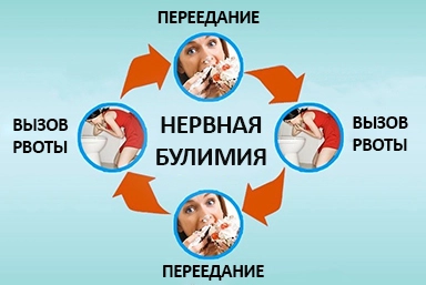 Лечение булимии в Североуральске